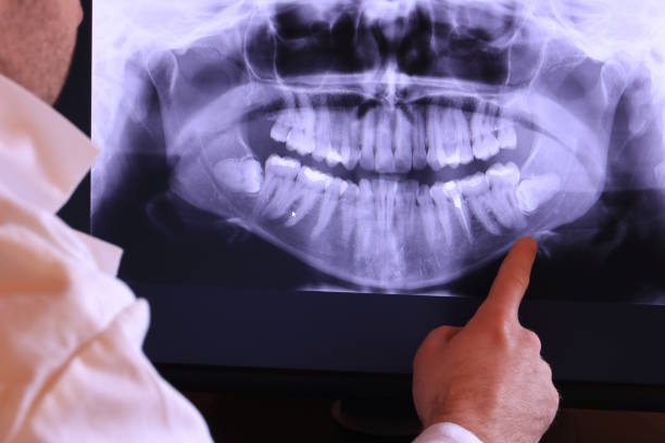 Best Broken or Cracked Tooth Emergency Dentist in Lasalle, IL